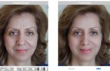 Jak reteuszować twarz na zdjęciu ? Jak poprawić zdjęcie twarzy online ?